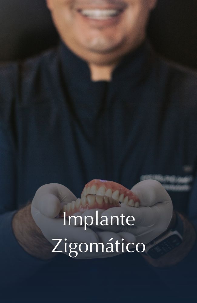 Implante Zigomático v2