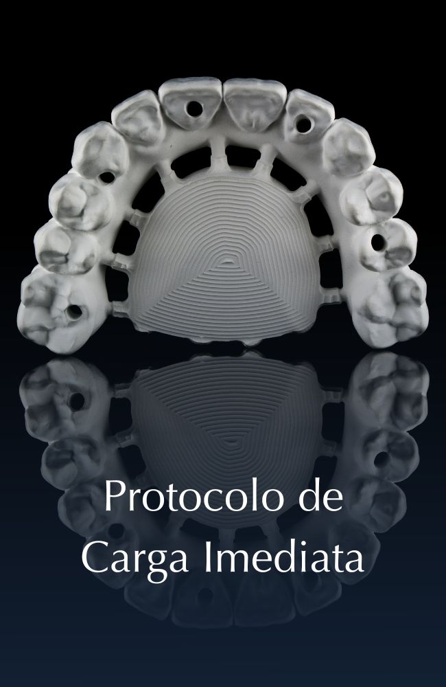 Protocolo de carga imediata v3