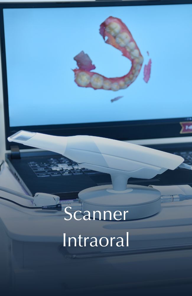 Scanner Intraoral v2